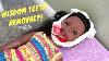 Wisdom Teeth Removal American Girl Doll Stopmotion
